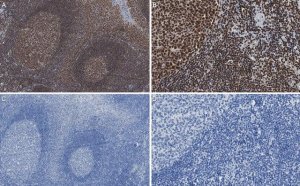 Anti-Smith Antigen Antibody, clone Y12 