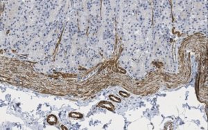 Anti-Sodium-Iodide Symporter Antibody, clone ARN1 