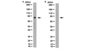 Anti-sodium/hydrogen exchanger 3 Antibody, clone 3H3 