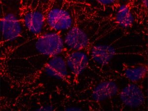 Anti-SORBS2 antibody, Mouse monoclonal 