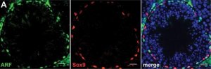 Anti-Sox9 Antibody 