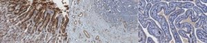 Anti-SPMD3 (nSMase2) Antibody, clone 14G5.1 