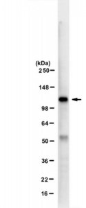 Anti-SREBP-1 