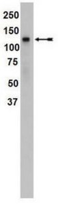 Anti-SREBP1 Antibody, clone 2121 