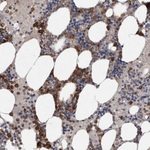 Anti-SRP68 antibody produced in rabbit 