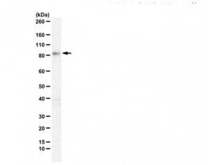Anti-STRN3 