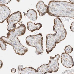 Anti-STT3A antibody produced in rabbit 