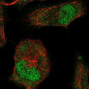 Anti-T antibody produced in rabbit 