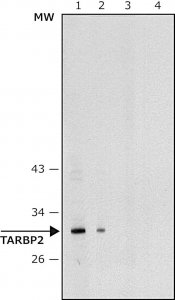 Anti-TARBP2 antibody produced in rabbit 