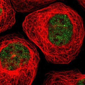 Anti-TARDBP antibody produced in rabbit 