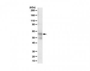 Anti-Tau (TauC4 Antibody, 354-369) 