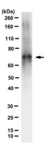 Anti-Tau Antibody, clone 2A1-2E1 