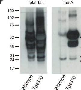 Anti-Tau-1 Antibody, clone PC1C6 