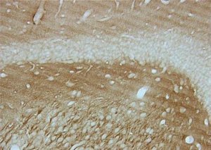 Anti-Tau-1 Antibody, clone PC1C6 