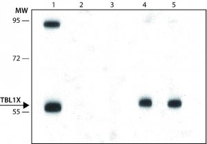 Anti-TBL1X antibody, Mouse monoclonal 