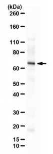 Anti-TBR-2 