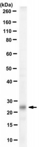 Anti-Tentonin 3/TMEM150c 
