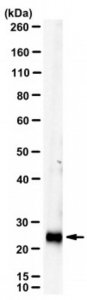 Anti-Tetranectin/CLEC3B Antibody, clone mAb10 