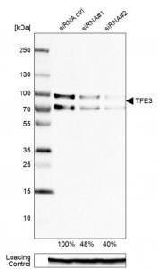 Anti-TFE3 antibody produced in rabbit 