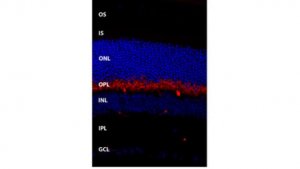 Anti-TMEM16B Antibody, clone 13B8 