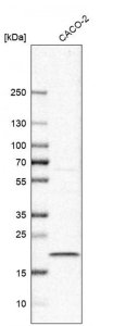 Anti-TMEM199 antibody produced in rabbit 
