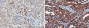 Anti-TMPRSS2 Antibody, clone P5H9-A3 