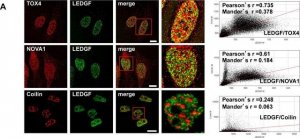 Anti-TOX4 antibody produced in rabbit 