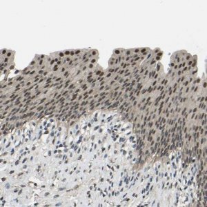 Anti-TOX4 antibody produced in rabbit 