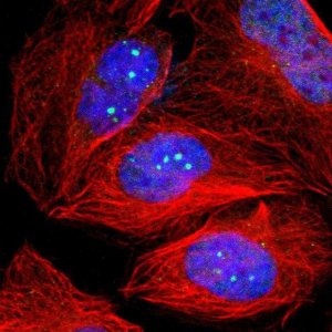 Anti-TP53BP1 antibody produced in rabbit 
