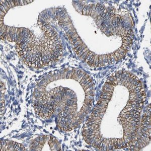 Anti-TRAF6 antibody produced in rabbit 