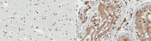 Anti-Transcription Initiation Factor IIA subunit 1 