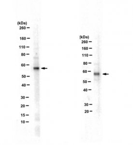 Anti-Transcription Initiation Factor IIA subunit 1 
