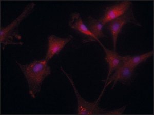 Anti-Transglutaminase-2 (C-terminal) antibody produced in rabbit 