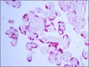 Anti-Transglutaminase-2 (C-terminal) antibody produced in rabbit 