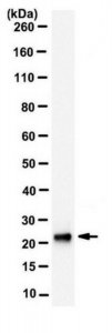 Anti-Troponin I Antibody, clone 5C11.1 