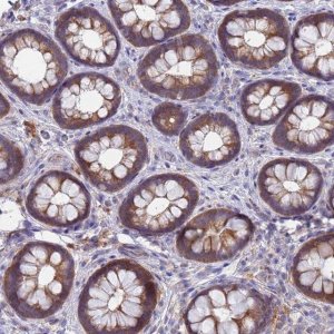 Anti-TTLL11 antibody produced in rabbit 