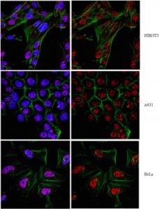 Anti-Twist1 (Twist-related protein 1) Antibody 