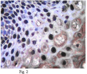 Anti-Twist1 (Twist-related protein 1) Antibody 