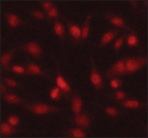 Anti-Twist1 antibody produced in rabbit 