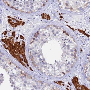 Anti-UBE2O antibody produced in rabbit 