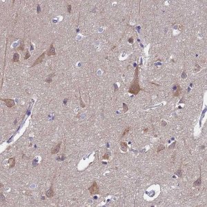 Anti-UBE2O antibody produced in rabbit 