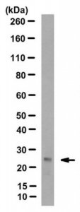 Anti-Ubiquitinated Histone H2B (Lys123) Antibody, clone 1B3F12/A9 