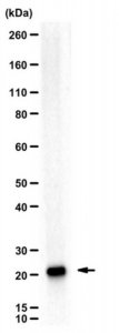 Anti-Ubiquityl Histone H2B (Lys120) 