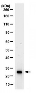Anti-Ubiquityl-Histone H2B Antibody, clone 56 