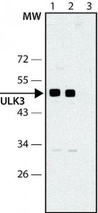 Anti-ULK3 antibody produced in rabbit 