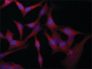Anti-VAC14 (C-terminal) antibody produced in rabbit 