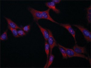 Anti-VAC14 antibody produced in rabbit 