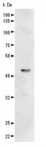 Anti-Vaccinia related kinase-1 Antibody, C-Terminus 