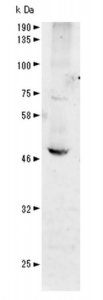 Anti-Vaccinia related kinase-1 Antibody, N-Terminus 