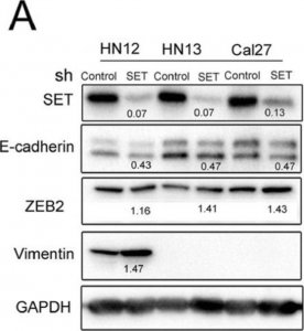 Anti-Vimentin antibody, Mouse monoclonal 